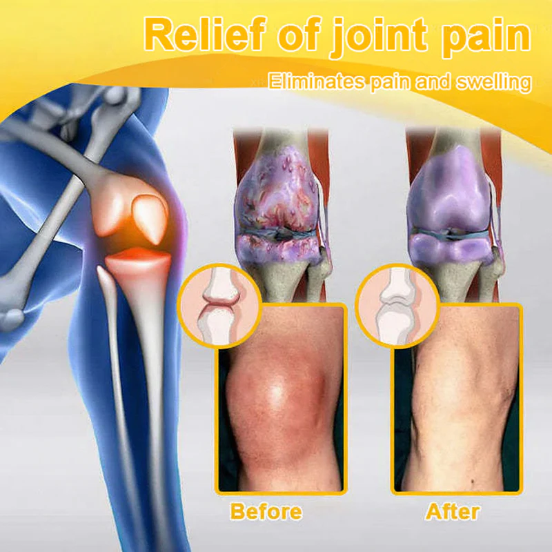 NovaRX®  Bee Venom Pain-Relief Joint Soothing Spray