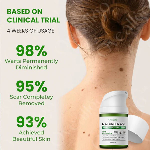 ✅ Official Store: Oveallgo® NatureErase Instant Mole & Spot Cream