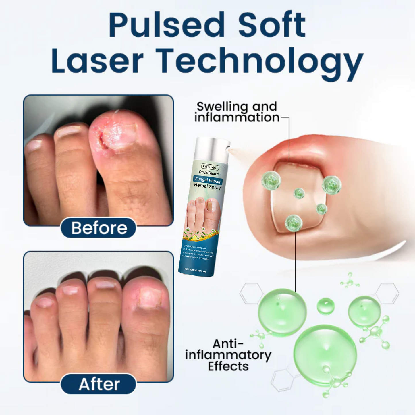 Fivfivgo® OnyxiGuard Fungal Repair Herbal Spray