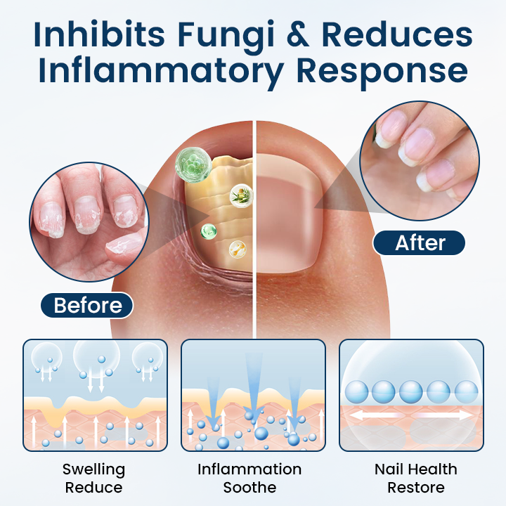 Fivfivgo® OnyxiGuard Fungal Repair Herbal Spray