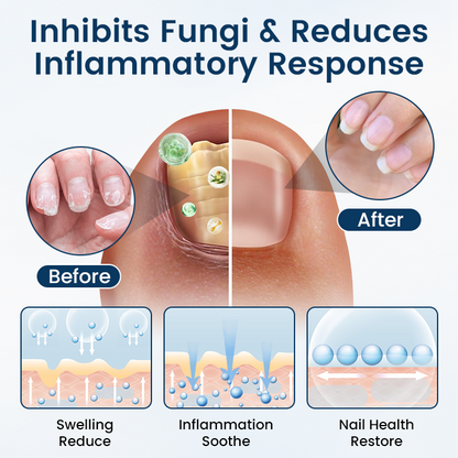 Fivfivgo® OnyxiGuard Fungal Repair Herbal Spray