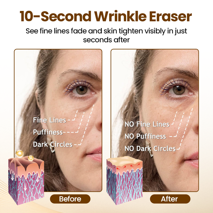 Oveallgo® Liftora 10s Wrinkle Serum