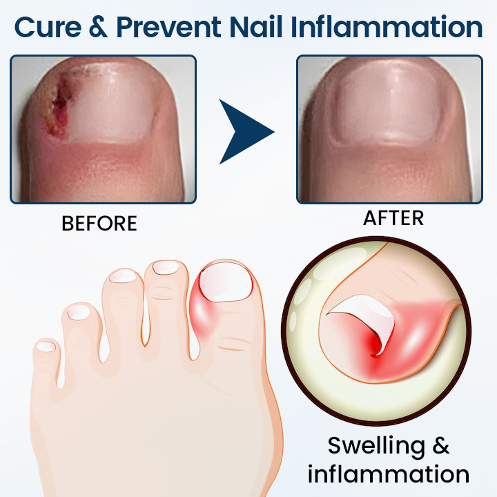 Fivfivgo® OnyxiGuard Fungal Repair Herbal Spray