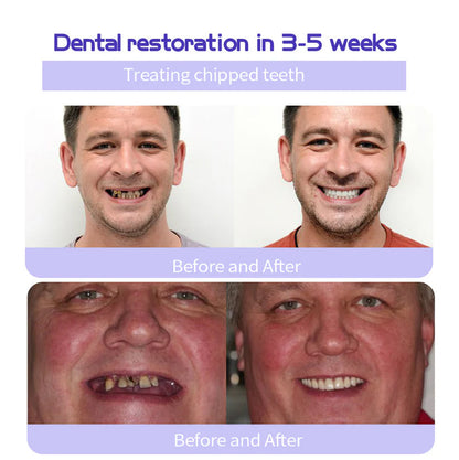 Fivfivgo® Teeth Restoration Mineral Powder