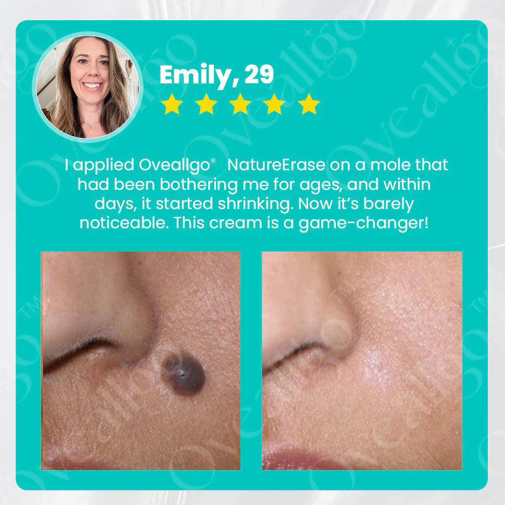 ✅ Official Store: Oveallgo® NatureErase Instant Mole & Spot Cream