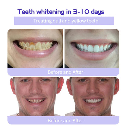 Fivfivgo® Teeth Restoration Mineral Powder
